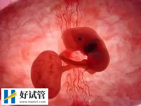 试管婴儿胎停育后下次备孕前要做哪些检查(图1) 试管婴儿胎停育后下次备孕前要做哪些检查(图1)