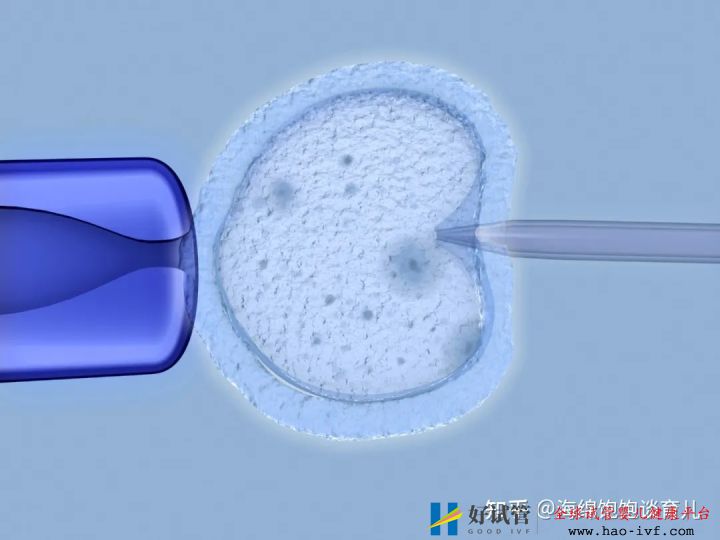 试管婴儿1代、2代、3代、4代哪个最好真实操作过...(图12) 试管婴儿1代、2代、3代、4代哪个最好真实操作过...(图12)